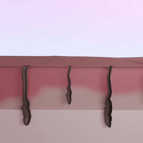 5MINSKIN-HAIR-ZAPPER-2.0 DISPOSITIVO-DE-DEPILACIÓN-LÁSER-EN-CASA